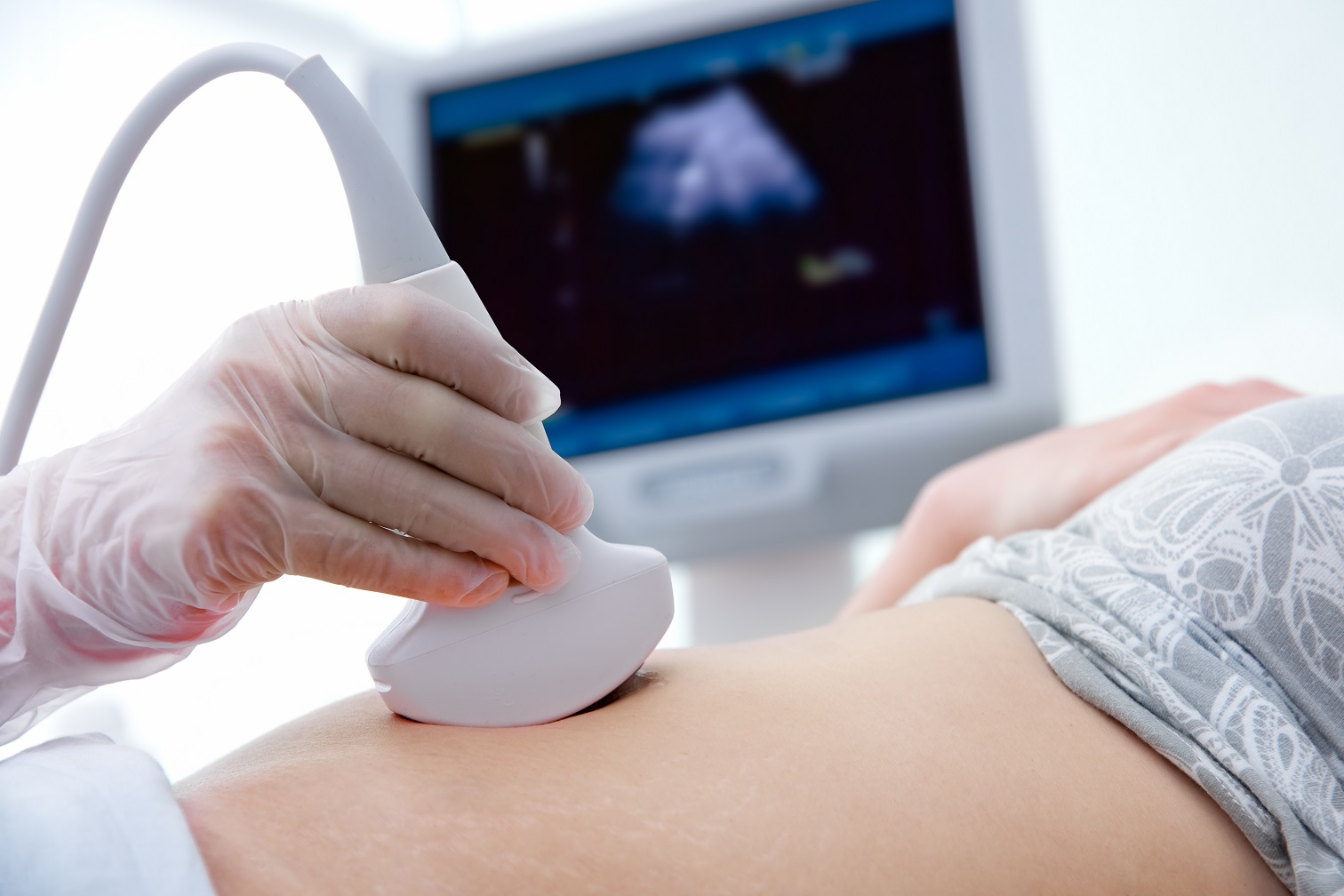 Ab der 4. SSW kann mit dem Ultraschall eine Schwangerschaft bestätigt werden